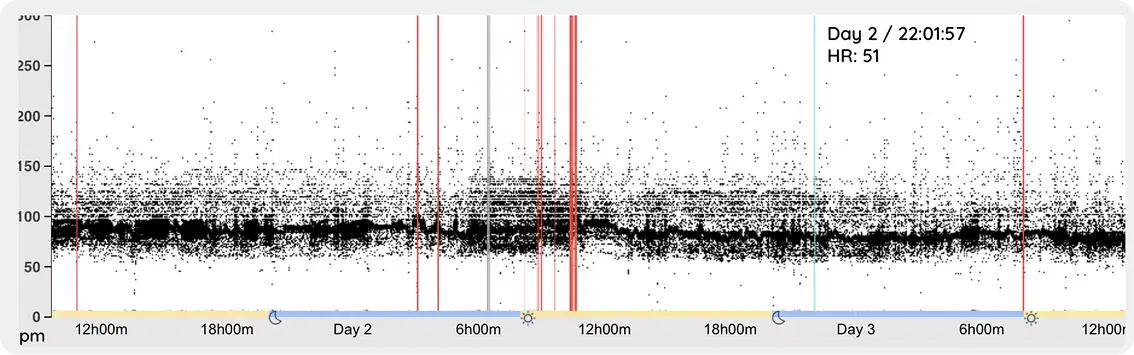 AI based Alerts & Alarms